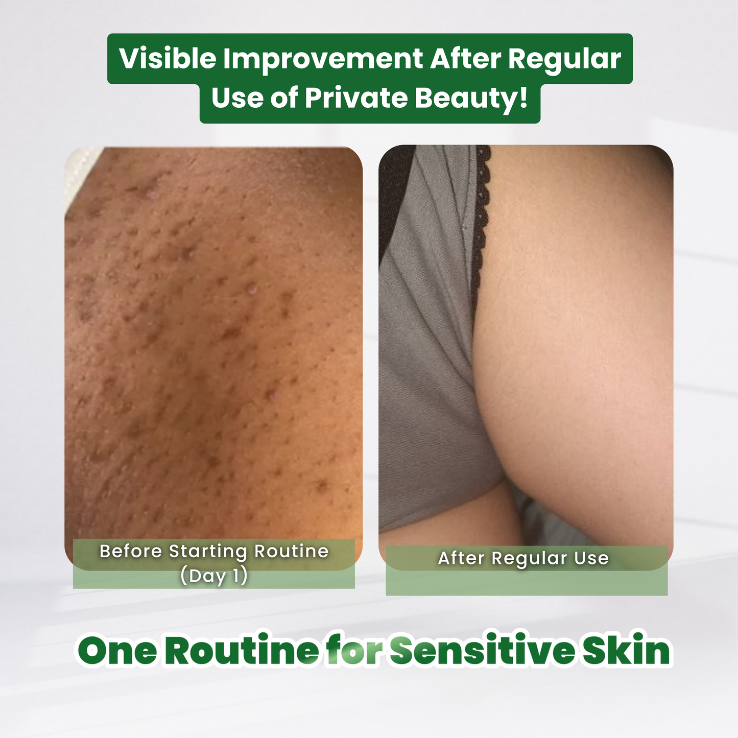 [20% OFF] Private Pamper Bundle (Full Body Bloom)