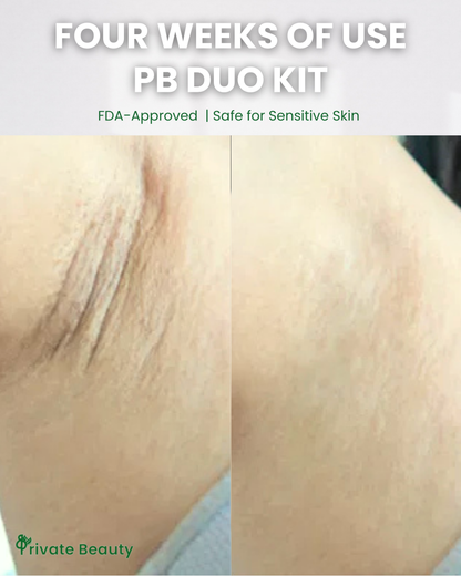 UA Whitening Fresh Duo Kit