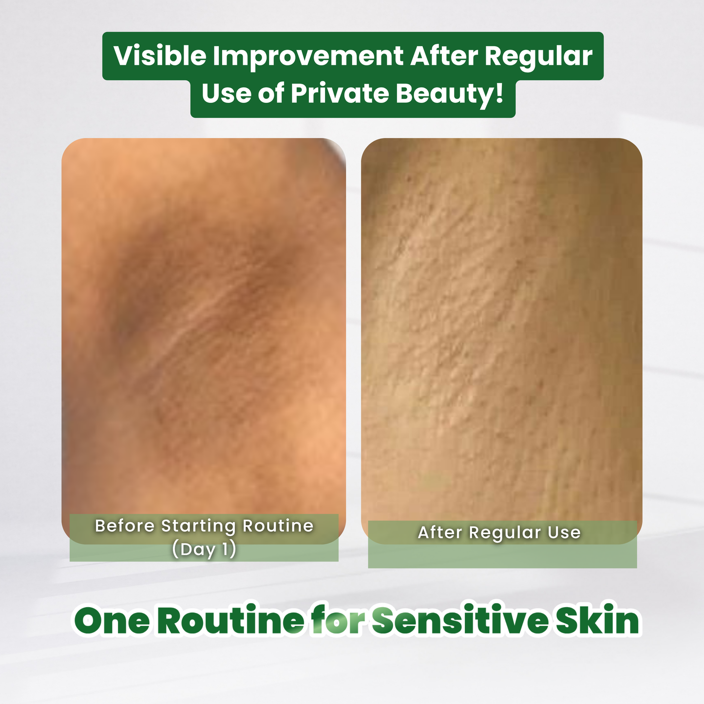 [5.5] UA Whitening Fresh Duo Kit