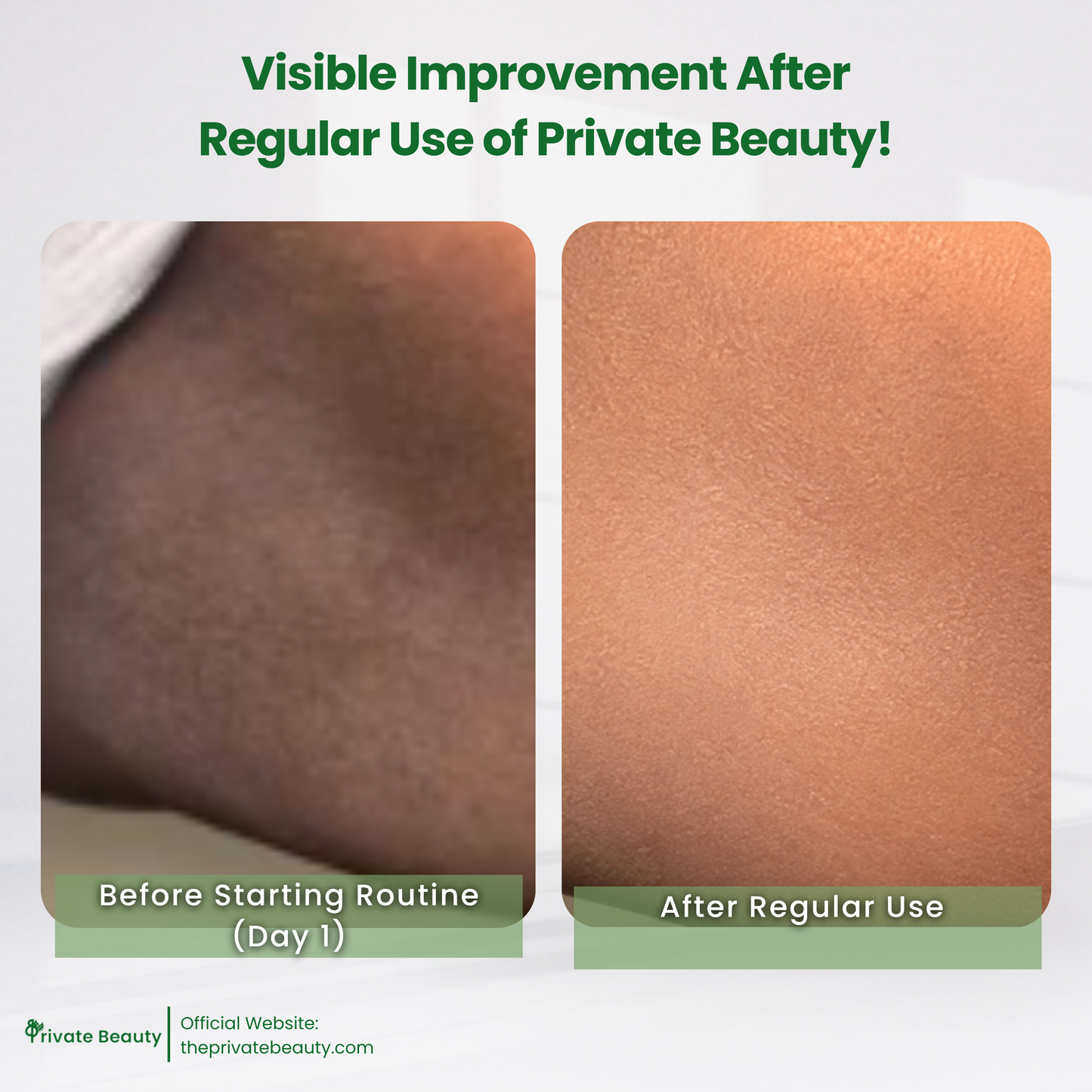 Private Trio Power Peel Set