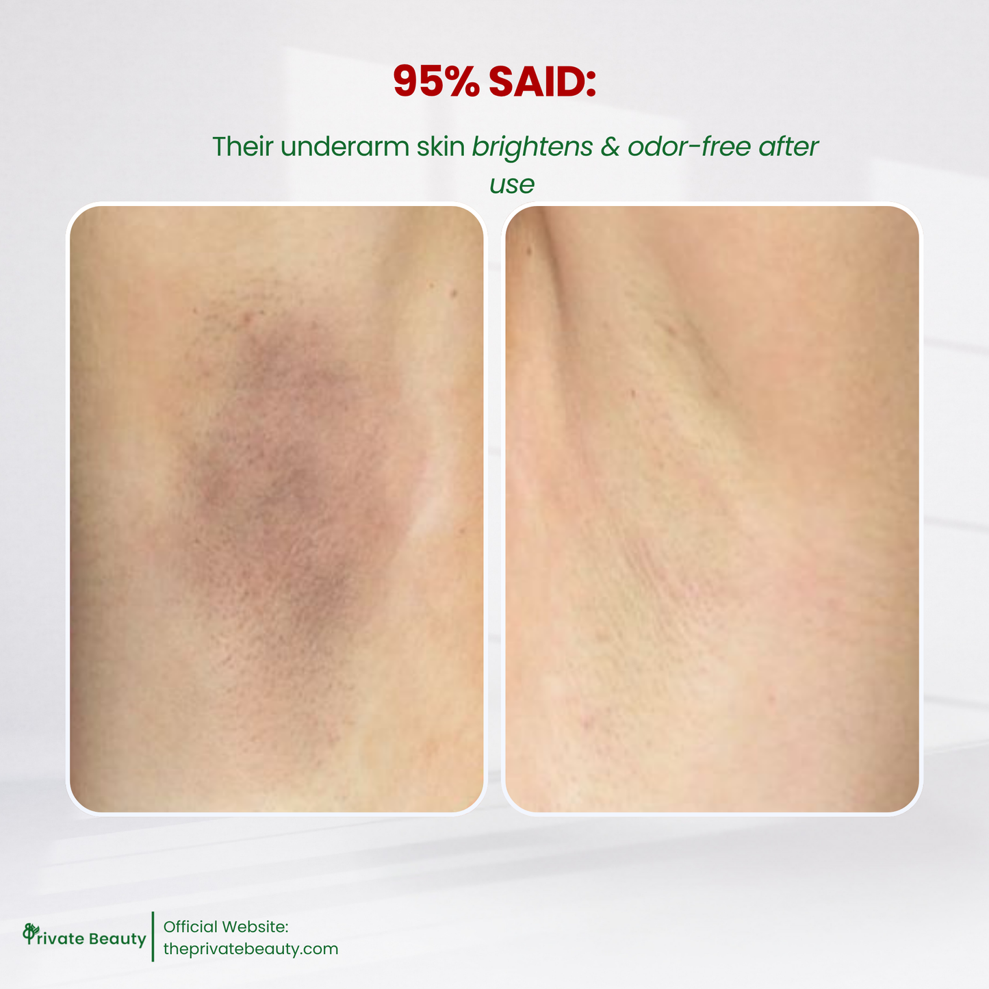 Private Beauty Anti-Sweat Glow Fresh Deo Spray