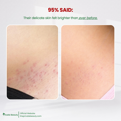 Private Beauty Exfoliating Peeling Serum