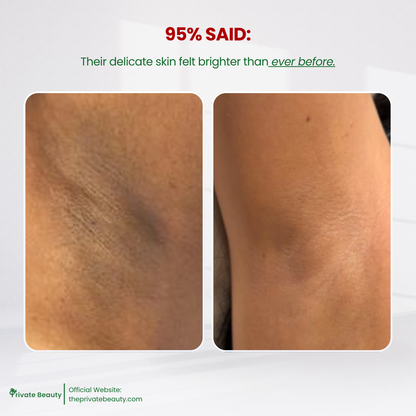 [PAYDAY SALE] Private Beauty Inguinal Whitening Serum