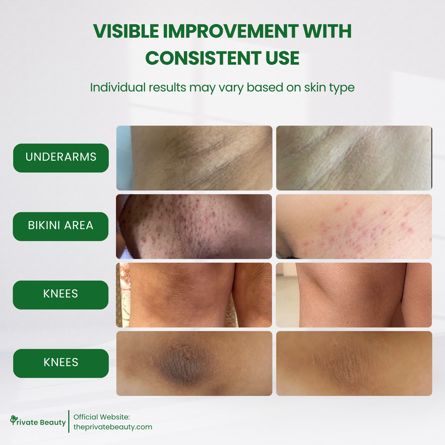 [PAYDAY SALE] Private Beauty Inguinal Whitening Serum