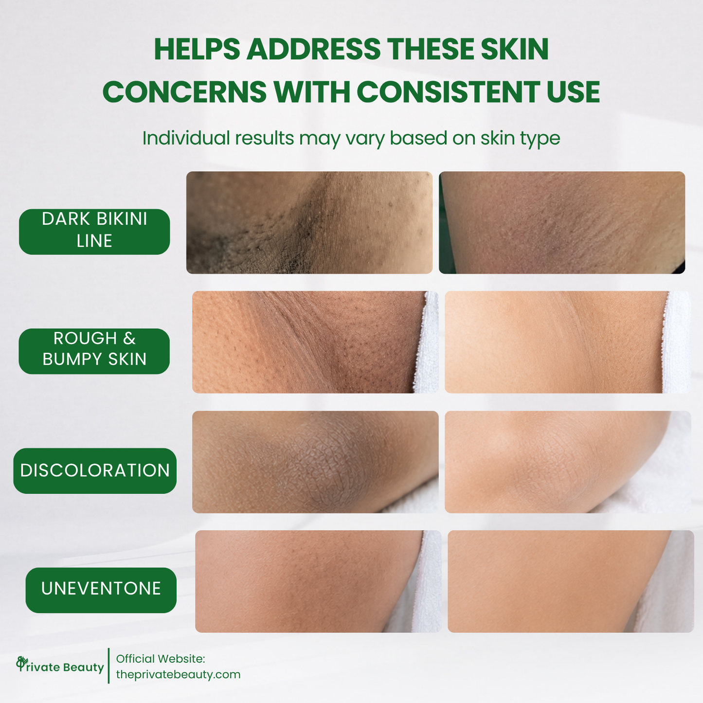Private Trio Power Peel Set