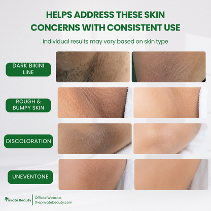Private Trio Power Peel Set