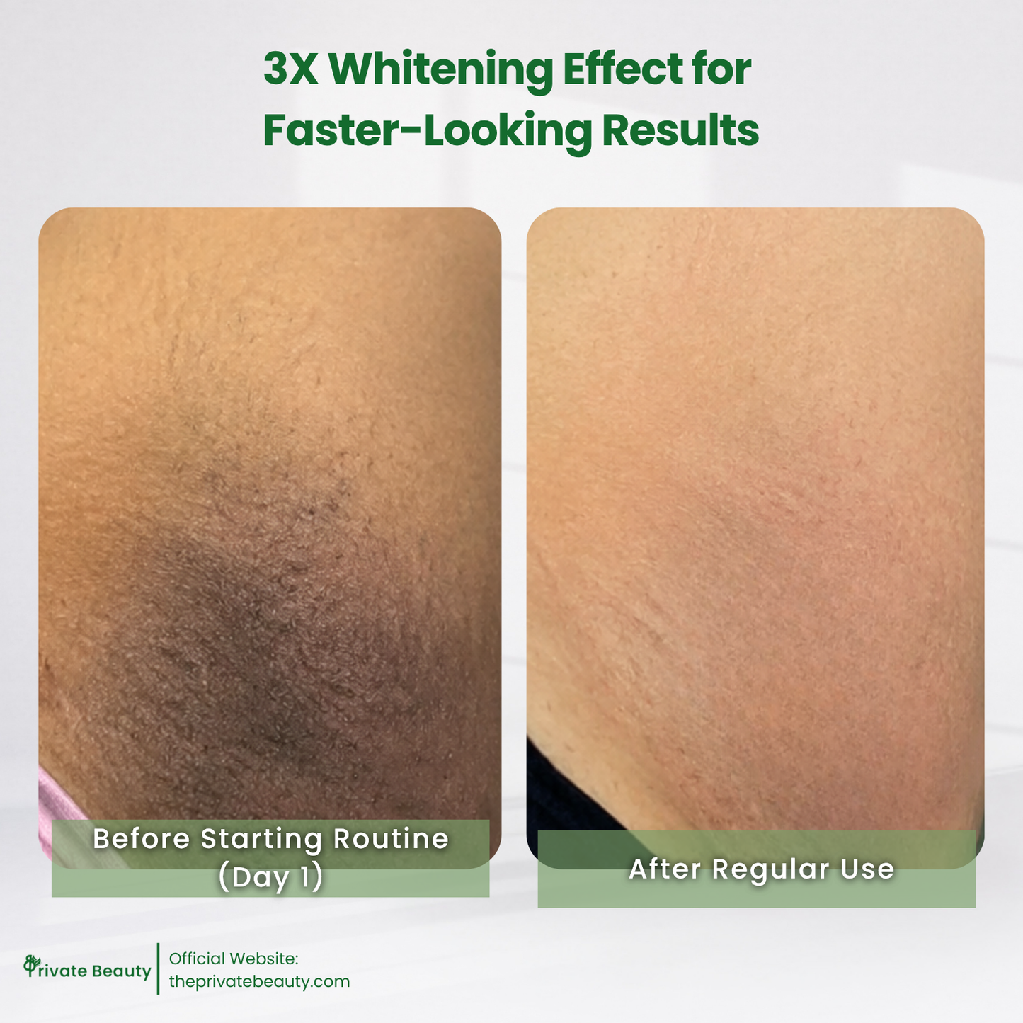 Private Trio Power Peel Set