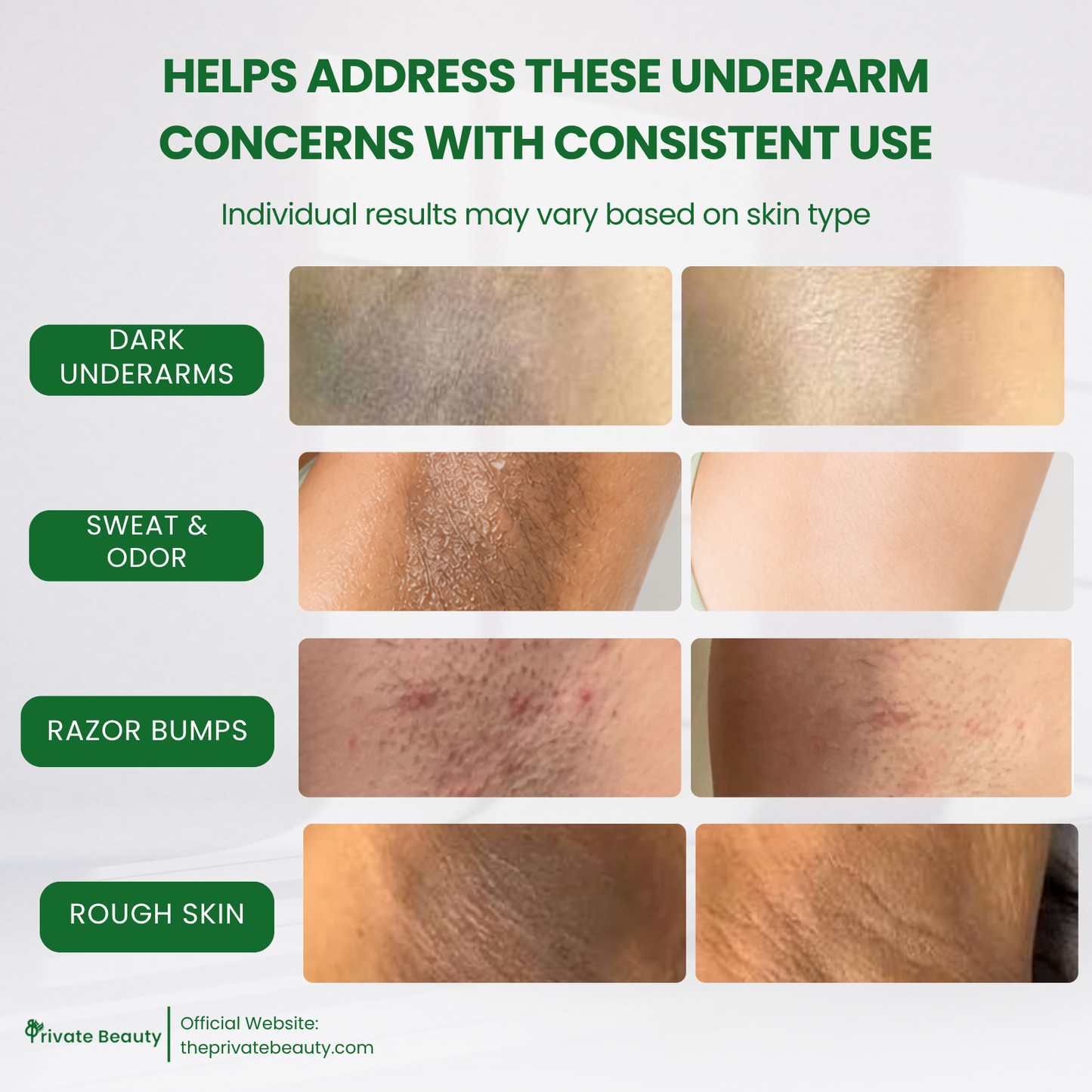 Private Beauty UA 3X Niacinamide Anti-Sweat Glow Trio