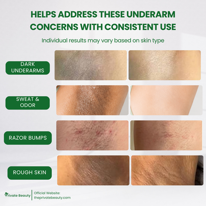 Private Beauty UA 3X Niacinamide Anti-Sweat Glow Trio